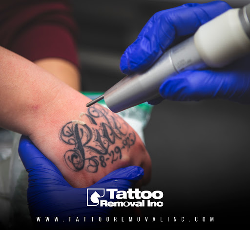 Explore nail tech tattoo ideas, creative tattoo ideas in South Gate, available at Tattoo Removal Inc
