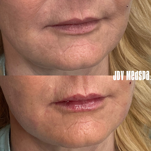 Explore gojo satoru tattoo ideas, creative tattoo ideas in Canton, available at JDV Med Spa