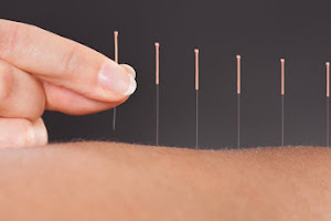 Beckenham Physiotherapy Sports & Acupuncture. Part of Physiotherapy Kent