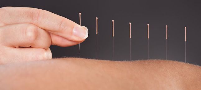 Beckenham Physiotherapy Clinic - Beckenham Physiotherapy Clinic