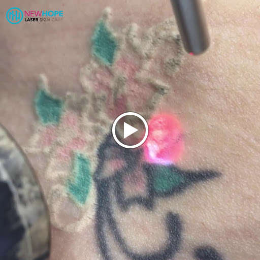 Explore see no evil tattoo ideas, creative tattoo ideas in Westminster, available at Newhope Laser Skin Care