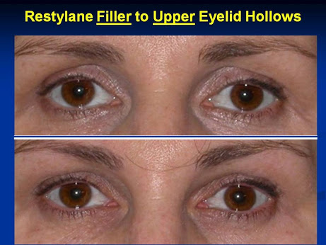 Mehryar Ray Taban MD - Oculoplastic Surgeon image