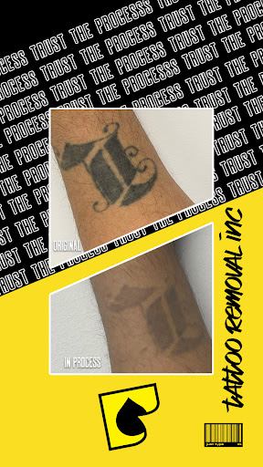 Explore symbol tattoo ideas, creative tattoo ideas in South Gate, available at Tattoo Removal Inc
