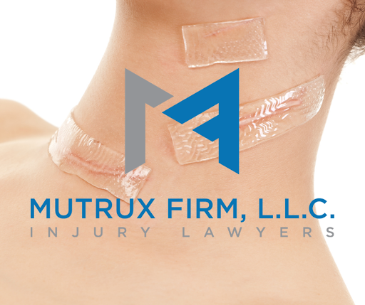 Personal Injury Attorney «Mutrux Finney, P.C. - Columbia», reviews and photos