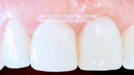 Dr. Farryl Jacobson - Herzliya Dental Clinic