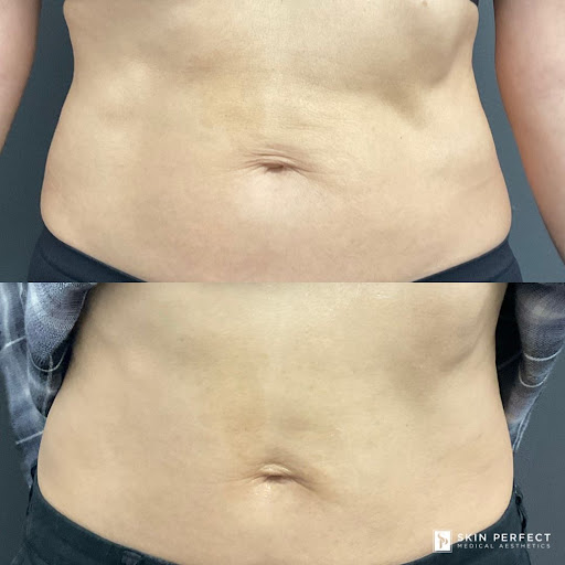 Explore tattoo ideas for women sleeve, creative tattoo ideas in Whittier, available at Skin Perfect Medical Aesthetics