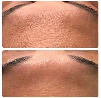 Valerie LoCicero - Licensed Esthetician - Photo 9 - Car repair in Clearwater, FL, Clearwater