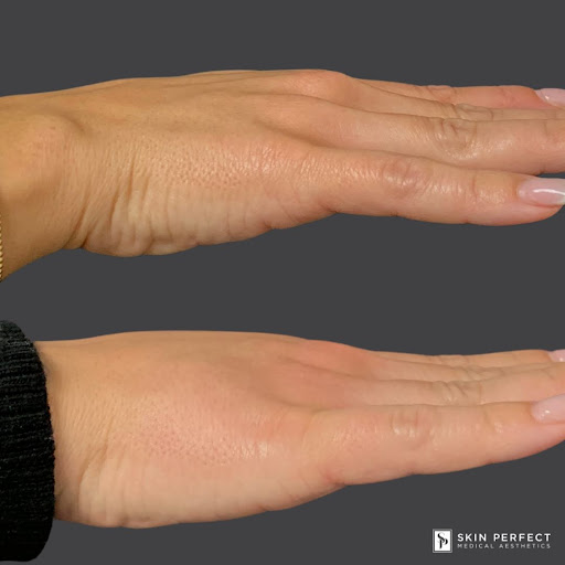 Find tattoo ideas with letters for your next unique tattoo in Whittier at Skin Perfect Medical Aesthetics