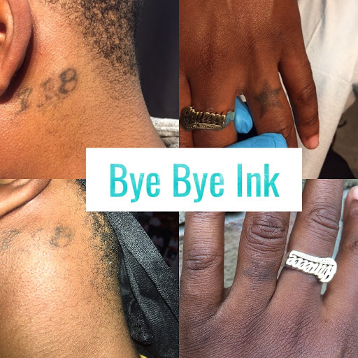 Explore tattoo ideas ear, creative tattoo ideas in Middle Village, available at Bye Bye Ink Laser Tattoo Removal