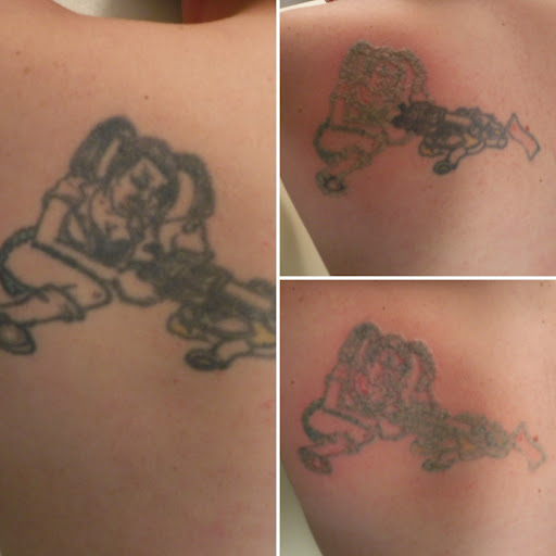 Explore r tattoo ideas, creative tattoo ideas in Morrisville, available at Regerts Ink Removal