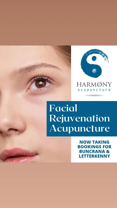 وئام الوخز بالإبر - Letterkenny - Harmony Acupuncture - Letterkenny