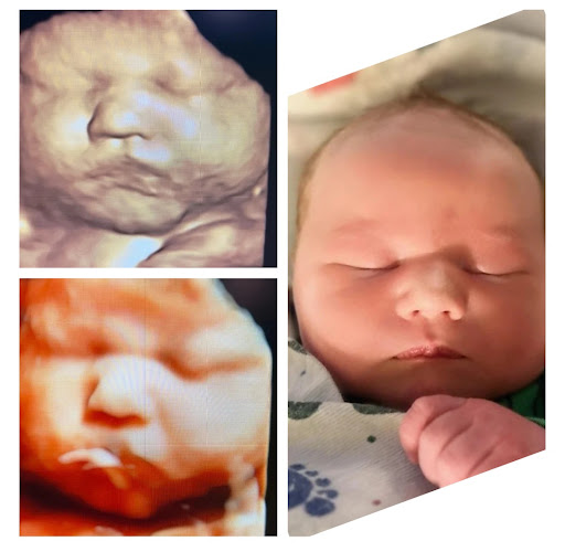 Baby Wave 4D Ultrasound image