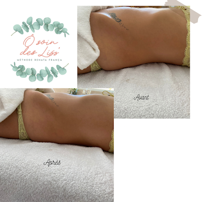 Ô soin des Liss' à Aubagne