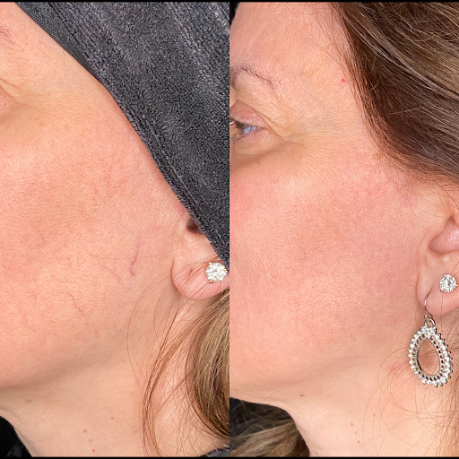 Explore side finger tattoo ideas, creative tattoo ideas in Brookfield, available at Milwaukee Laser & Body Aesthetics