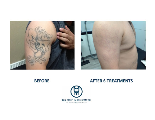 Explore baking tattoo ideas, creative tattoo ideas in San Diego, available at Removery Tattoo Removal & Fading