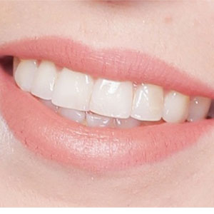 Capstone Dental Care image