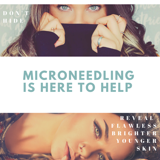 Explore hand tattoo cover up ideas, creative tattoo ideas in Lake Oswego, available at Oswego Beauty and Laser