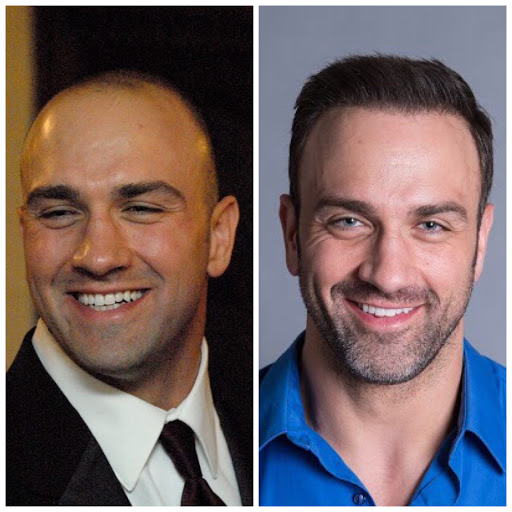 Hair Transplantation Clinic «Bosley Medical - Seattle», reviews and photos, 2505 2nd Ave #715, Seattle, WA 98121, USA