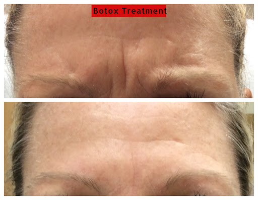 Explore tattoo ideas usa, creative tattoo ideas in Lake Oswego, available at Lake Oswego Vein and Aesthetic LOVA