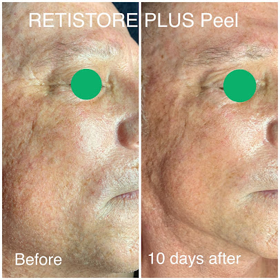 Simply Skin at Tamzyn - Simply Skin at Tamzyn