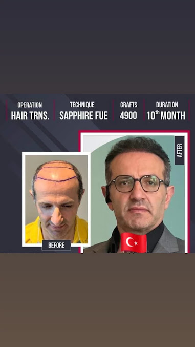 Hair Clinic Eko - Hair Clinic Eko