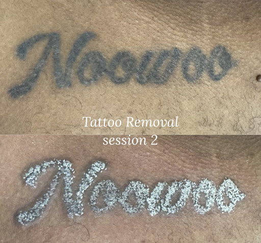 Explore sharingan tattoo ideas, creative tattoo ideas in Savannah, available at Haute Brows. Cosmetic Tattoo