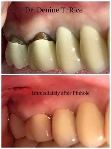 Dental implants periodontist Riverside