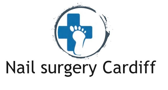 Reviews of Nail surgery Cardiff - Ingrown toenail removal in Cardiff - Podiatrist