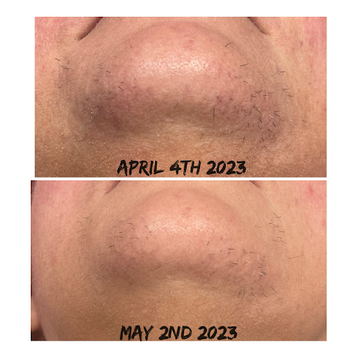 Explore tattoo cover up ideas for shoulder, creative tattoo ideas in Des Moines, available at Bare Beaute Permanent Hair Removal By Electrolysis, LLC