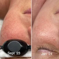 Lunar Bloom Esthetics - Car repair in Mishawaka, IN, South Bend - Rated 5.0/5