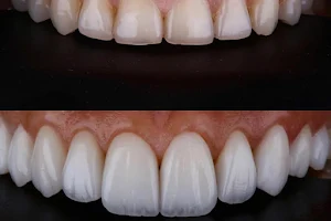 Smile Vallarta Dentist image