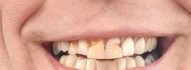 Carlton Dental Care - Dentist