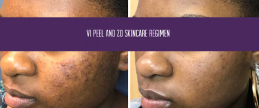 Explore tattoo letters ideas, creative tattoo ideas in Baton Rouge, available at Louisiana Laserderm