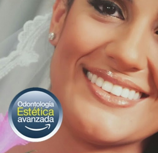 Diseño De Sonrisa Medellín - Esthetic Dentistry