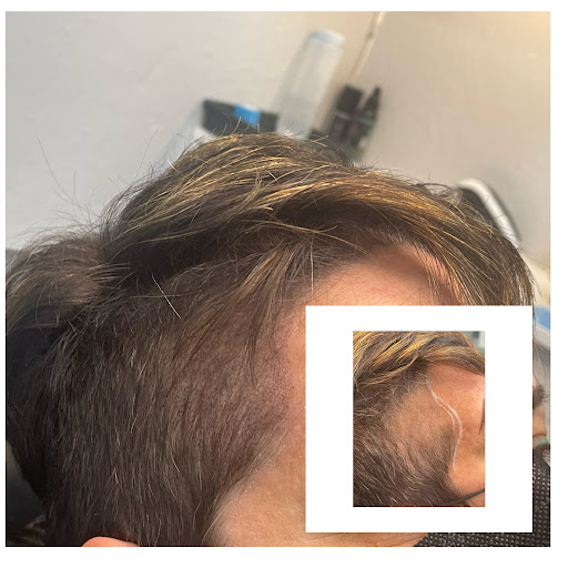 Explore tattoo idea for kids, creative tattoo ideas in Roseville, available at NuHair Ink. Scalp MicroPigmentation & Aesthetic Clinic of Sacramento