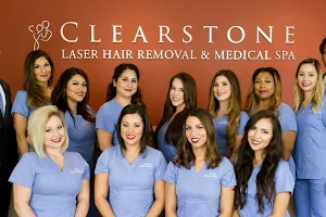 Clearstone Laser Hair Removal image