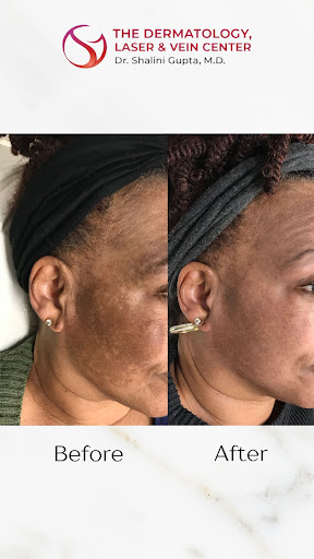 Explore small forget me not tattoo ideas, creative tattoo ideas in Cincinnati, available at The Dermatology, Laser & Vein Center