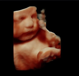 Meet The Baby - Ultrasound Scans | Warrington