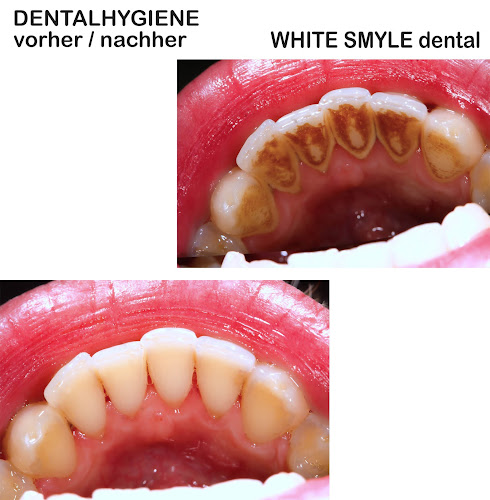 White Smyle - Zahnarzt, Zahnkorrektur, Implantate, Dentalhygiene & Bleaching - Zürich