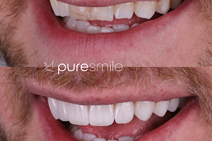 Areté Smile Design Center | Puresmile image