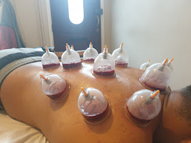 CUPPING WORKS (MOBILE SERVICE ONLY) HIJAMA