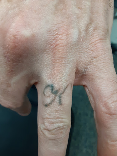 Explore gon tattoo ideas, creative tattoo ideas in Saint Paul, available at Fearless Tattoo Removal