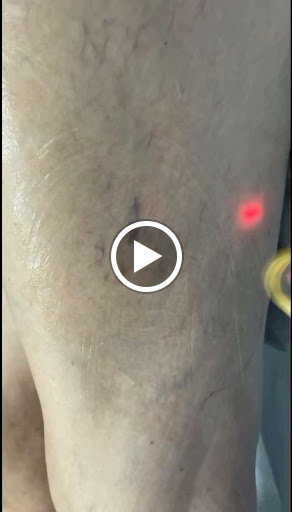 Explore daughter birth tattoo ideas, creative tattoo ideas in Lake Oswego, available at Lake Oswego Vein and Aesthetic LOVA