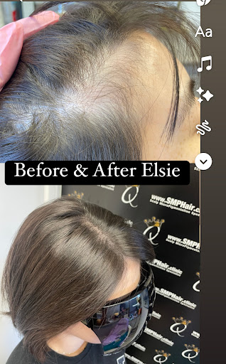 SMP Hair Clinic The Queen Of Scalp image