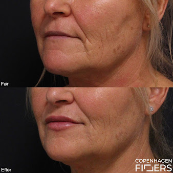 Thomas Kjær Uhlig - Medical Aesthetic - Thomas Kjær Uhlig - Medical Aesthetic