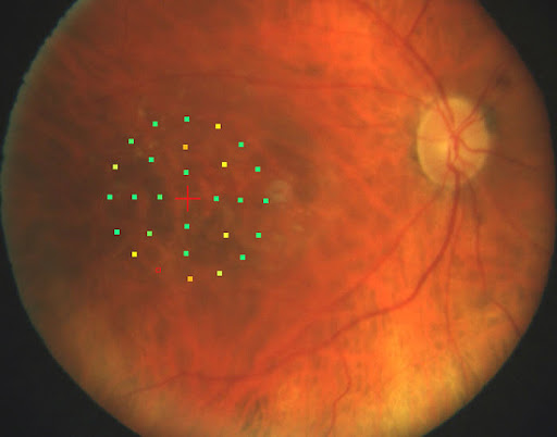 Eye Care Center «American Vision of Bayside», reviews and photos, 41-01 Bell Blvd, Bayside, NY 11361, USA