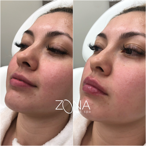 Skin Care Clinic «ZONA MED SPA», reviews and photos, 9767 N 91st St #102, Scottsdale, AZ 85258, USA