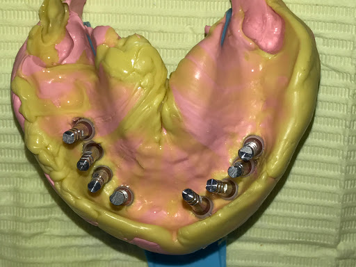 Esthetix Dentist, NYCs Dental Implant & Cosmetic Specialist image 8