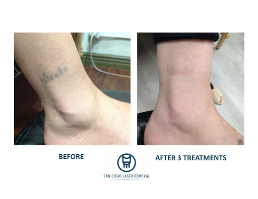 Explore dates tattoo ideas, creative tattoo ideas in San Diego, available at Removery Tattoo Removal & Fading