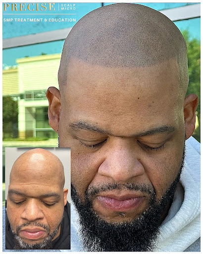 Precise Scalp Micro - Scalp Micropigmentation Service and Training image